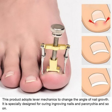 Professional ingrown toenail corrector - lifter - stainless steelEquipment
