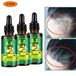 3 pieces - hair growth liquid - ginger essence - 7 days treatmentHair