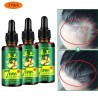 3 pieces - hair growth liquid - ginger essence - 7 days treatmentHair