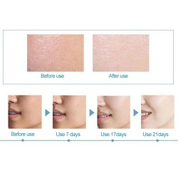 Hyaluronic acid essence - moisturizing - anti wrinkle - anti allergy - face lift serumSkin