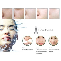 Hyaluronic acid essence - moisturizing - anti wrinkle - anti allergy - face lift serumSkin