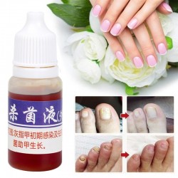 Chinese medicine - nail repair for onychomycosis - nail fungus - 10 mlTreatment