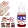 Chinese medicine - nail repair for onychomycosis - nail fungus - 10 mlTreatment