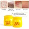 Medical cream - herbal ointment - psoriasis / eczema / pruritus / dermatitis / pain reliefSkin