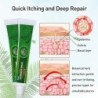 Psoriasis cream - dermatitis - eczema - anti-itch - herbal antibacterial ointmentSkin