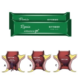 Hemorrhoids ointment - herbal gel - external / internal treatment - 5 piecesSkin