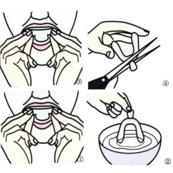 Silicone overnight mouthguard - teeth whitening - against grinding / clenching - 4 piecesTeeth Whitening