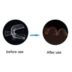 Silicone overnight mouthguard - teeth whitening - against grinding / clenching - 4 piecesTeeth Whitening