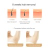 ZS - mini laser IPL epilator - permanent hair removal - 600000 pulsed light - detachable lampHair removal
