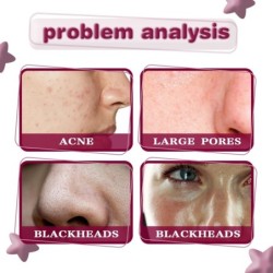 Face serum - fruit acid essence - AHA - BHA - acne treatment - whitening - 30mlSkin