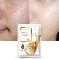 Snail essence face mask - moisturizing - oil control - acne treatment - 5 piecesSkin