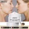 Snail extract face cream - collagen - hyaluronic acid - anti-wrinkle / whitening / moisturizingSkin