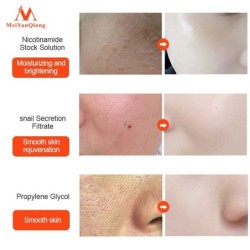 Snail extract face serum - moisturizing / whitening / anti wrinkle / anti acneSkin