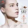 Snail extract face serum - moisturizing / whitening / anti wrinkle / anti acneSkin