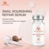 Snail extract face serum - moisturizing / whitening / anti wrinkle / anti acneSkin