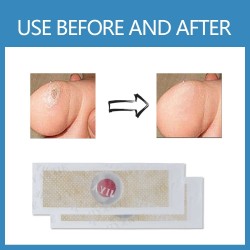 Foot corn / warts removal plasters - 12 piecesFeet