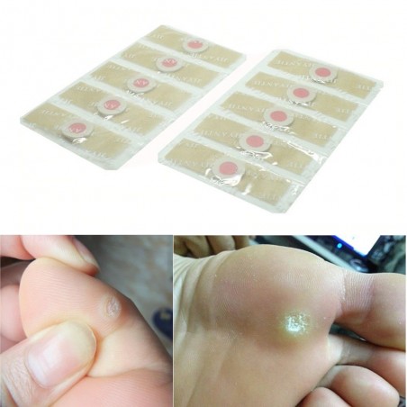 Foot corn / warts removal plasters - 12 piecesFeet