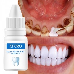 Teeth Whitening serum - gel - oral hygiene - toothpasteTeeth Whitening