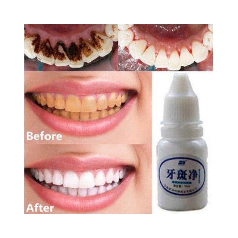 Teeth whitening water 10 mlMouth