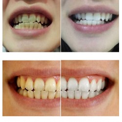 Teeth whitening water 10 mlMouth